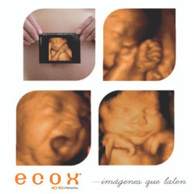 Ecografía emocional: ilusión y ternura